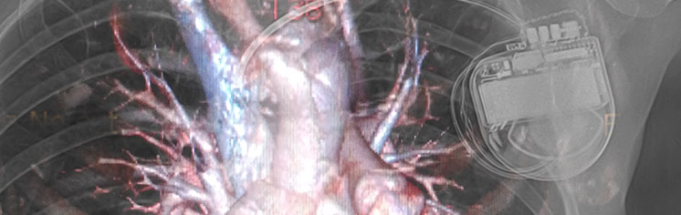 CARDIAC-SOLUTIONS